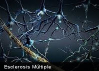 A propósito del Día Mundial: ¿Qué es la Esclerosis Múltiple?