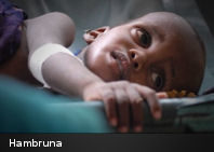 Más de 450 millones de menores padecen malnutrición