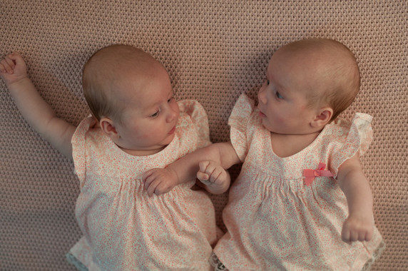 La cesárea, factor de riesgo para el desarrollo psicológico en gemelos