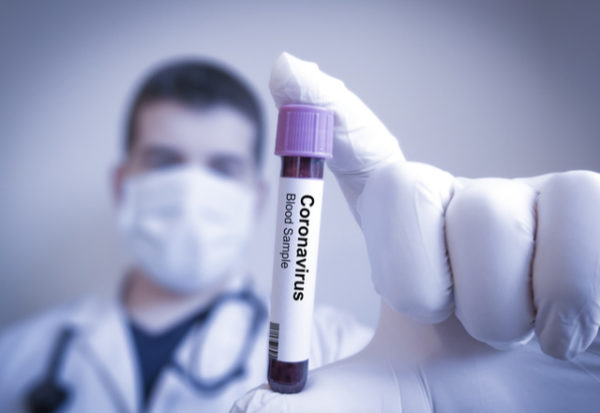 Diez buenas noticias sobre el coronavirus (un año después)