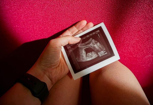 Por qué son tan comunes los abortos espontáneos