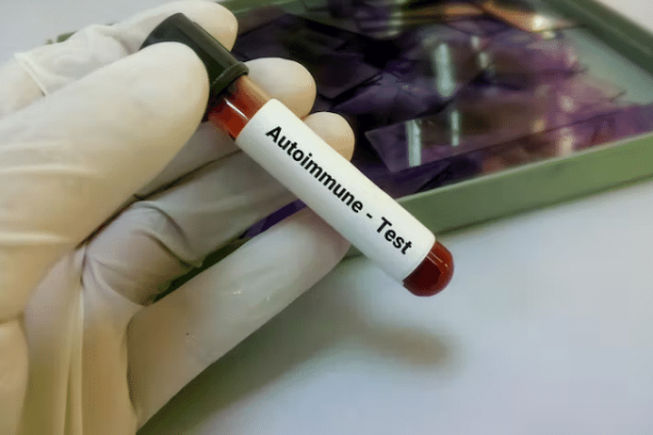 Enfermedades autoinmunes: cuando el enemigo es uno mismo