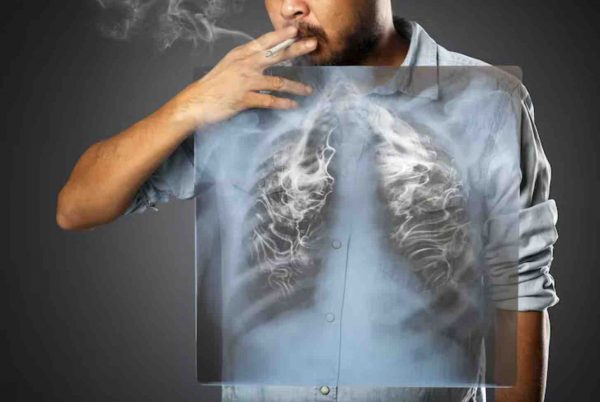 Cáncer de pulmón: buenas noticias desde la batalla para derrocar al emperador de los tumores