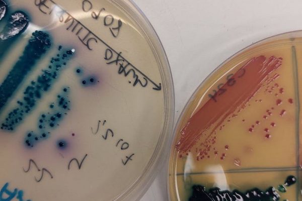 La carrera científica contra las bacterias multirresistentes