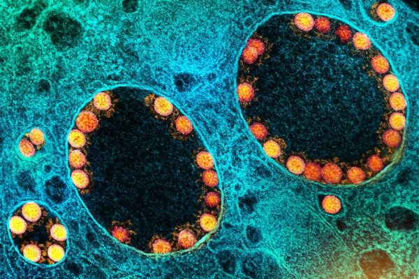 ¿Es el coronavirus un ser vivo?