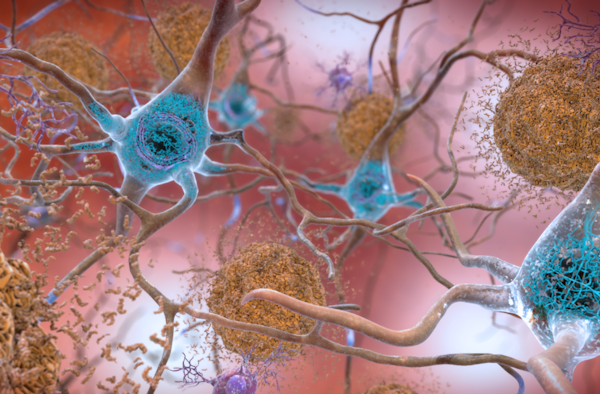 Una nueva estrategia para frenar la acumulación de proteínas vinculada a la ELA y el alzhéimer