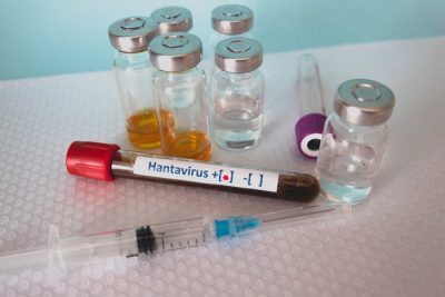 Así escapa el hantavirus al control del sistema inmunitario: ¿cómo puede evitarse?